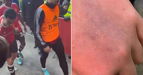 Torcedor agredido por Cristiano Ronaldo tem autismo e não quer voltar a estádio de futebol - Jornal Correio